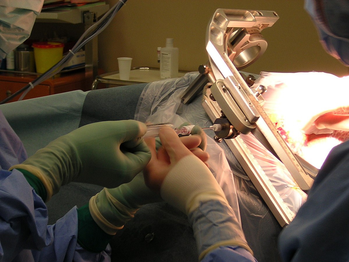 باحثون يطورون تقنية حوسبية لتقليل خزعات تشخيص الأمراض