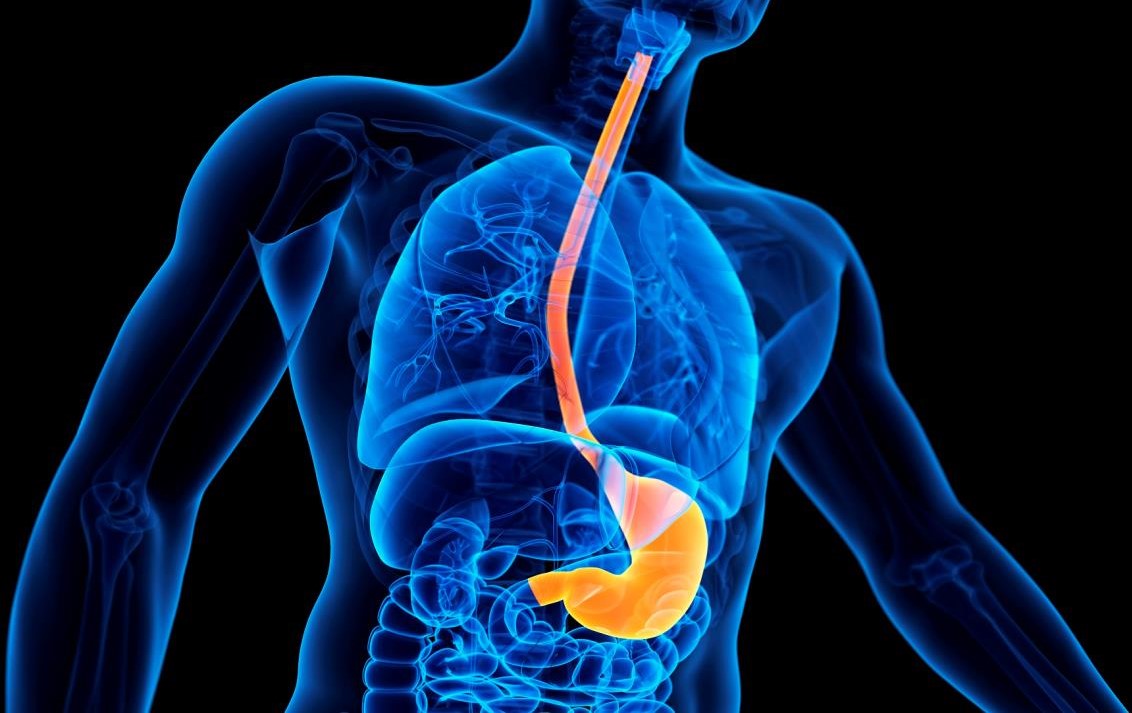 استشاري سعودي : هذه أسباب مرض الارتجاع الحمضي المريئي