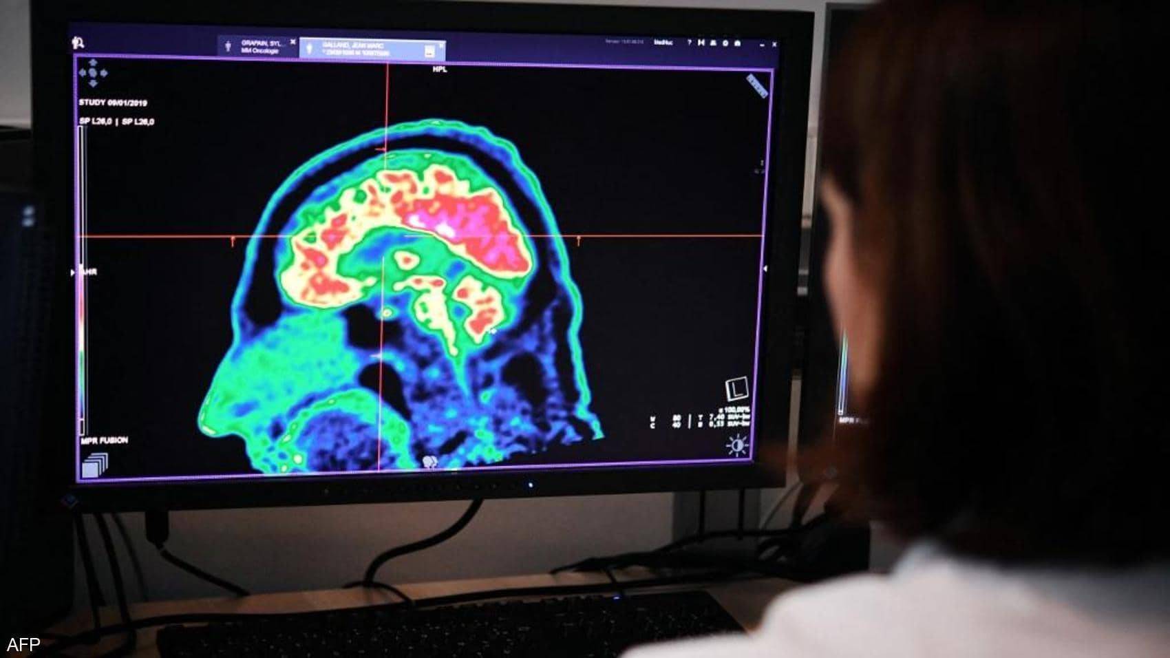 يساعد هذا الإنجاز على رصد الموجات الدماغية المرتبطة بالحلم.