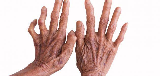 في مهب العشق