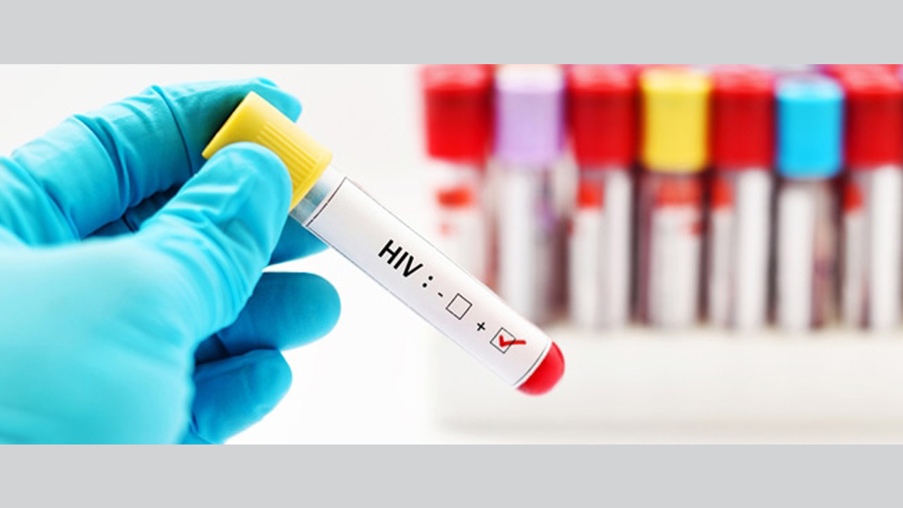 40 عاما على اكتشاف فيروس الإيدز