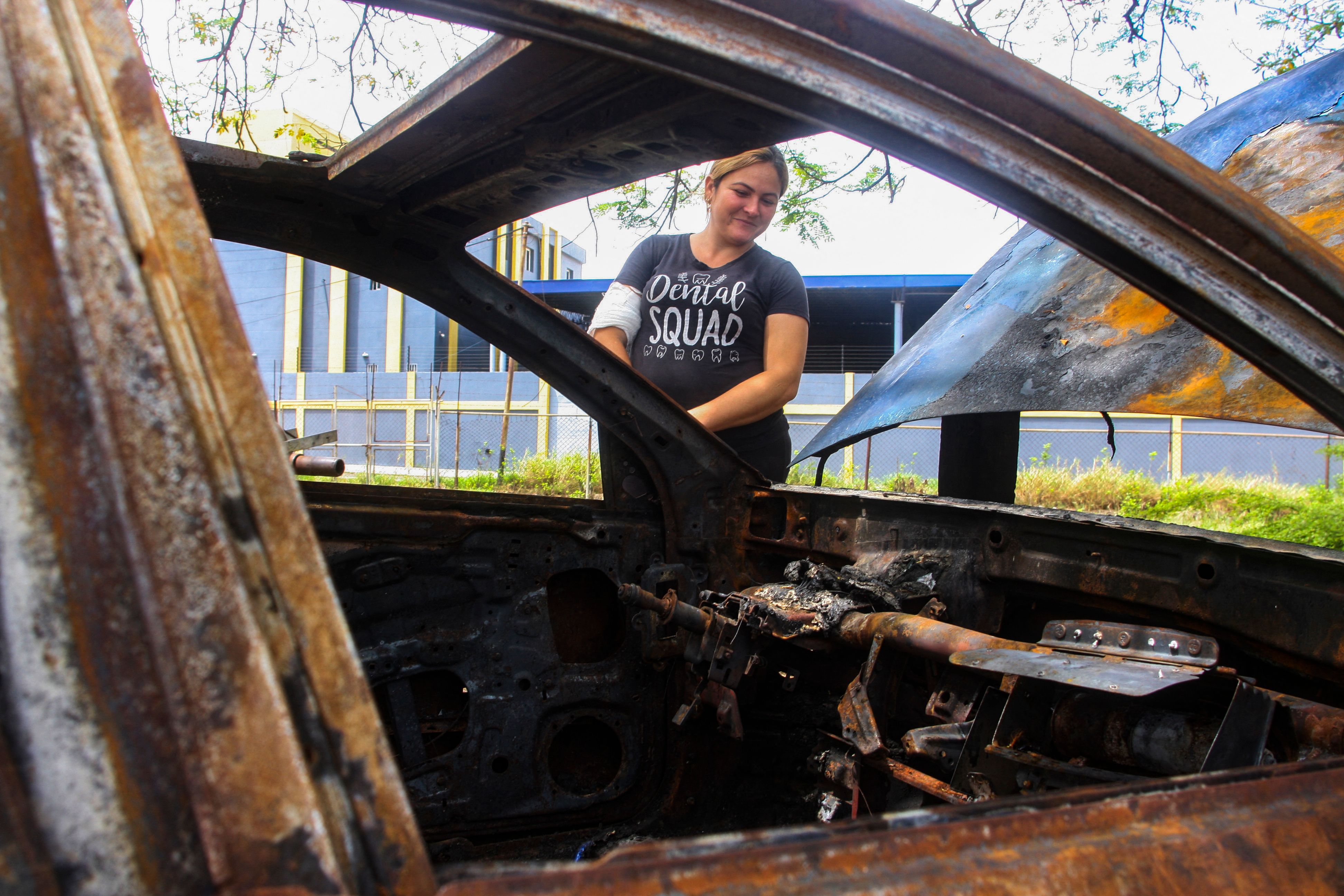 اشتعال مفاجئ للسيارات في فنزويلا يثير تساؤلات بنوعية البنزين