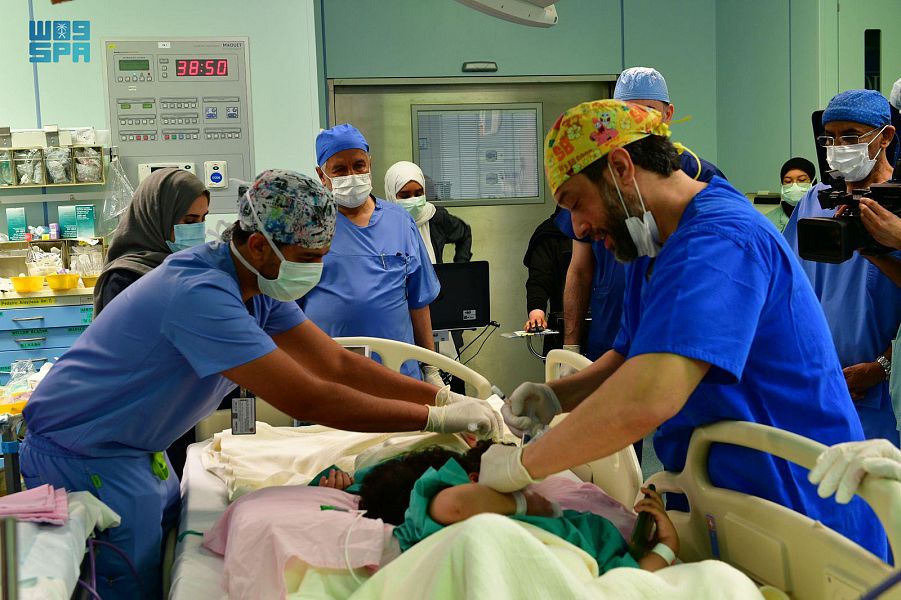 بعد عملية معقدة استغرقت 17 ساعة .. نجاح فصل التوأم السيامي المصري سلمى وسارة