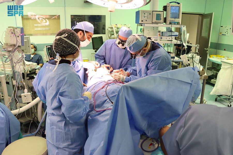 بعد عملية معقدة استغرقت 17 ساعة .. نجاح فصل التوأم السيامي المصري سلمى وسارة