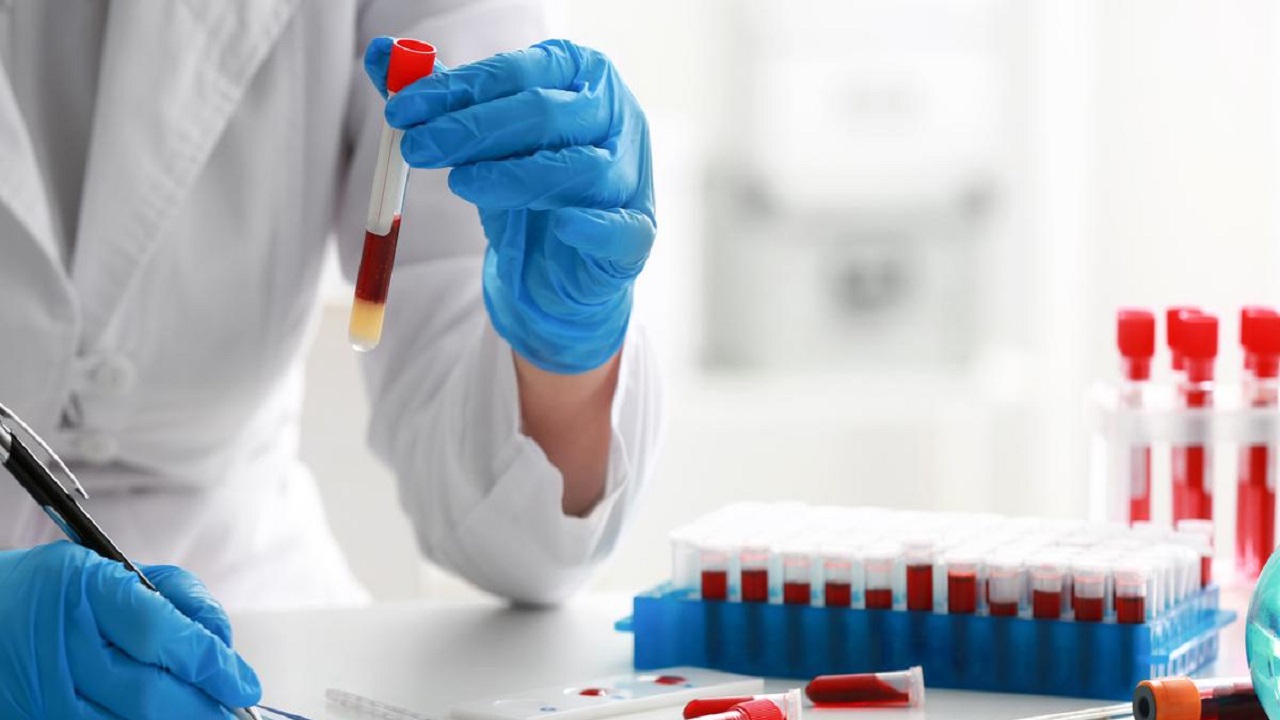 علاج جديد يقلص خطر تقدم نوع نادر من سرطان الدم بنسبة 74%