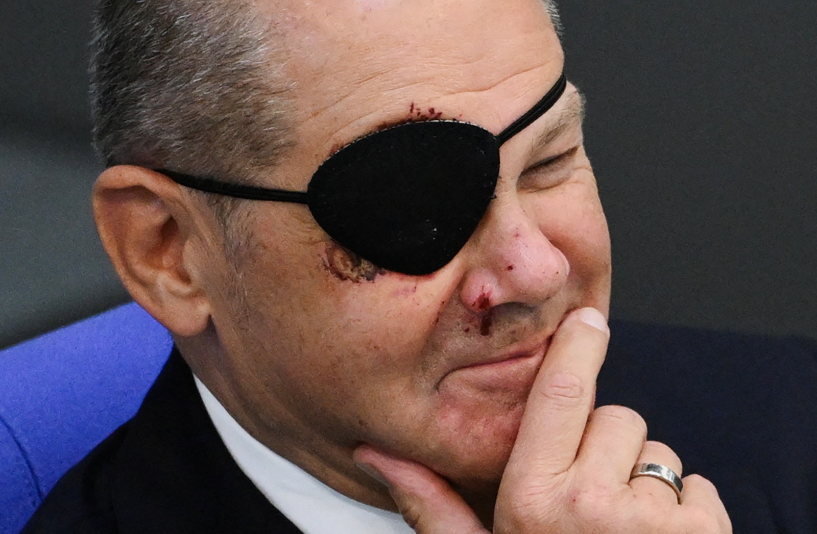 رقعة عين المستشار الألماني تثير سخرية كبيرة على الإنترنت