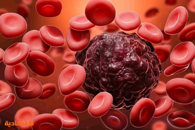 علاج جديد لنوع نادر من سرطان الدم .. يقلص الخطر 74 %