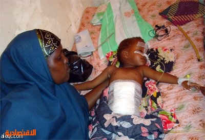 طفل في مستشفى المدينة في العاصمة الصومالية مقديشو أصيب بجروح خلال المواجهات بين قوات الحكومة الصومالية والمتمردين.