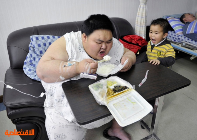 الصيني ليانغ يونغ يبلغ من العمر 30 عاما ووزنه 230 كيلو يرقد في المستشفى بعد محاولات عدة منذ 1998 لإنقاص وزنه الزائد  حيث  يعيش ح