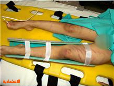 العنف ضد المرأة بالأرقام 46 منه نفسي والزوج المتهم الأول