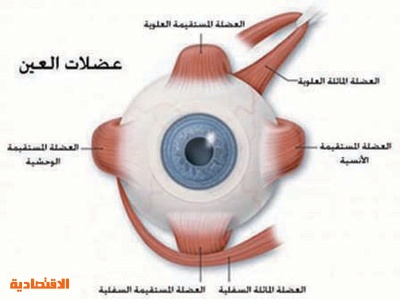 علاج كسل العين