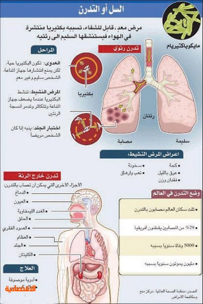 مرض السل طرق الوقاية ونصائح للمرضى صحيفة المواطن الإلكترونية