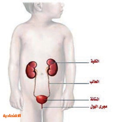 التهابات الجهاز البولي مشكلة شائعة لدى الأطفال