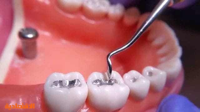 لا حشو أسنان بعد اليوم".. الطب الصيني يقدم الحل | صحيفة الاقتصادية