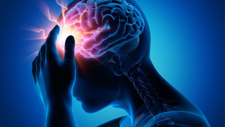 90 %  من حالات الإصابة بسكتة الدماغ يمكن تجنبها