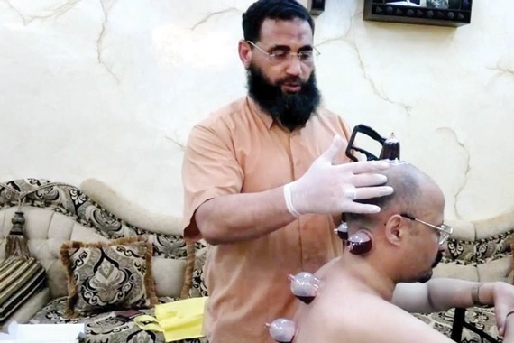 13 عيادة تمارس «الحجامة» بشكل نظامي.. 38 % منها في الرياض