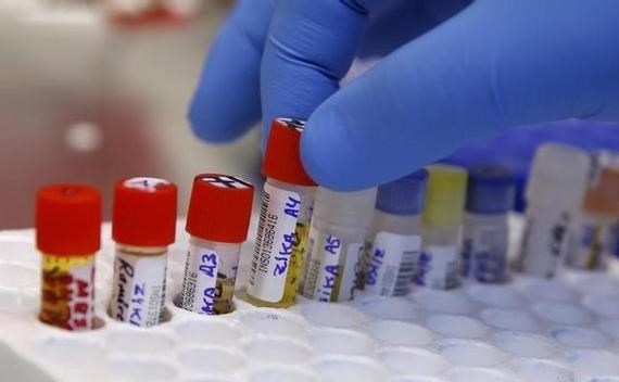 ظهور أول إصابة بفيروس زيكا في ولاية تكساس الأمريكية
