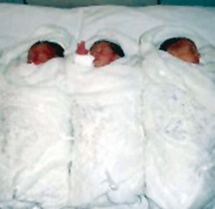 امرأة تنجب 3 توائم في «الحبيب»