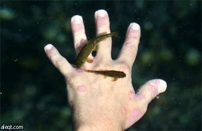 الاسماك Garra rufa obtusas المعروفة بـ"طبيب الأسماك" في تركيا يستخدم في علاج الأمراض الجلدية المزمنة.