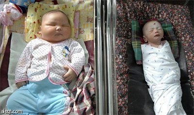 امرأة اندونيسية أنجبت طفل يزن 8.7 كيلوغرام (19.2 باوند) بواسطة عملية قيصرية أجريت في مستشفى كيسران العام في جزيرة سومطرة.