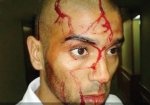 أخيرا .. مصر تقر بإلقاء «الحجارة».. والجزائر تستدعي سفيرها