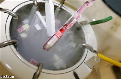 أطباء بريطانيون ينجحون في تجميد خلايا السرطان