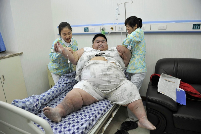 الصيني ليانغ يونغ يبلغ من العمر 30 عاما ووزنه 230 كيلو يرقد في المستشفى بعد محاولات عدة منذ 1998 لإنقاص وزنه الزائد  حيث  يعيش ح