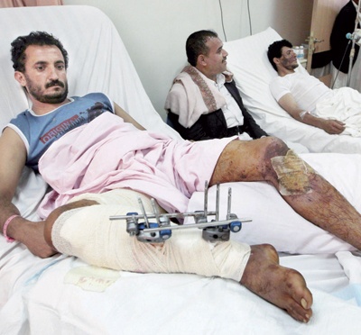 نقل 5 مسؤولين يمنيين لتلقي العلاج في الرياض .. وتجدد مواجهات العنف في صنعاء