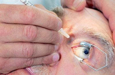 جهاز جديد للعين ينعش الآمال في استعادة البصر