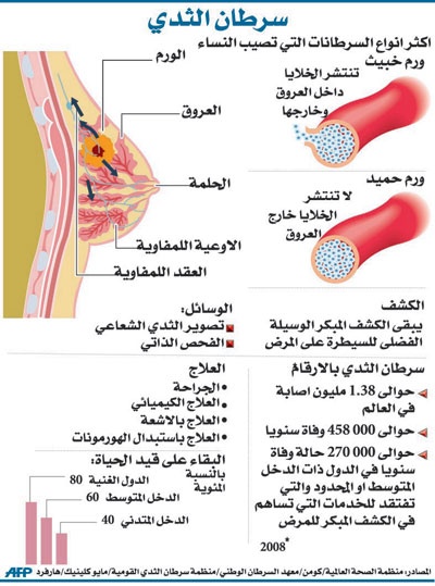 التصوير الإشعاعي يزيد خطر الإصابة بسرطان الثدي