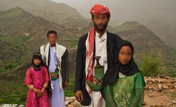 مصادر قبلية في اليمن تنفي وفاة فتاة قاصر تعرضت للإيذاء ليلة زفافها من زوجها الأربعيني
