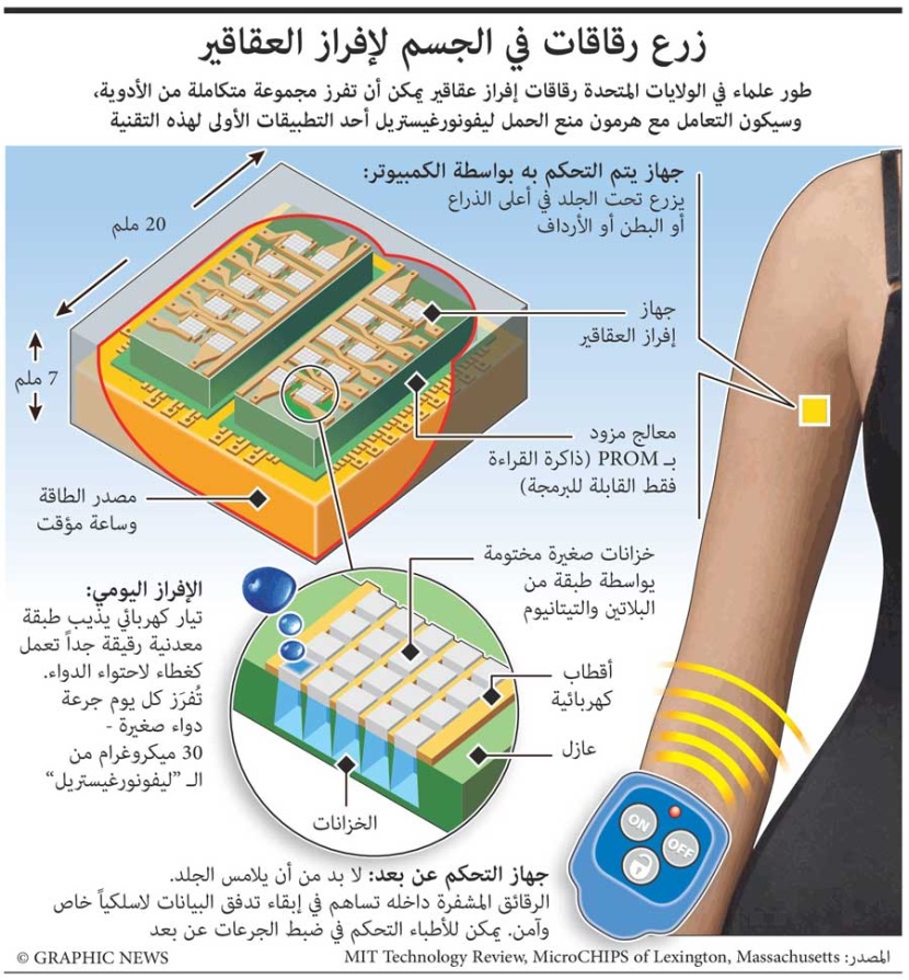 زرع رقاقات داخل الجسم لإفراز العقاقير