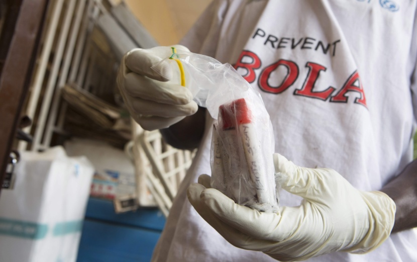 خبير فيروسات ألماني: فيروس إيبولا ليس معديا خلال فترة الحضانة