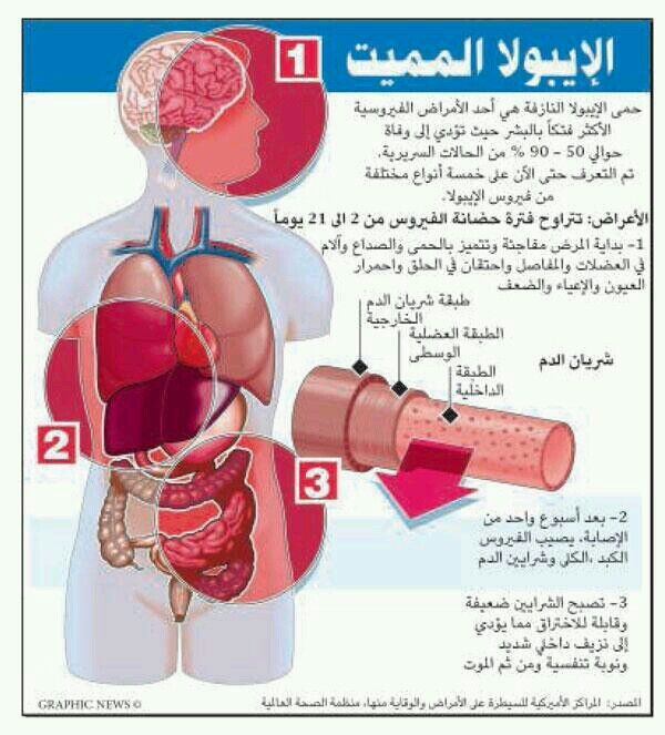 لماذا ينجو البعض من "ايبولا" .. دراسة تكشف الخيوط