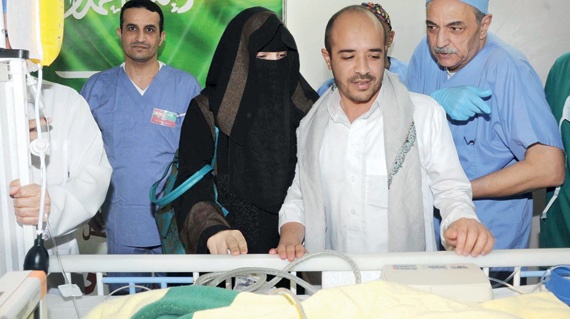 نجاح فصل التوأم السيامي اليمني في مدينة الملك عبدالعزيز الطبية