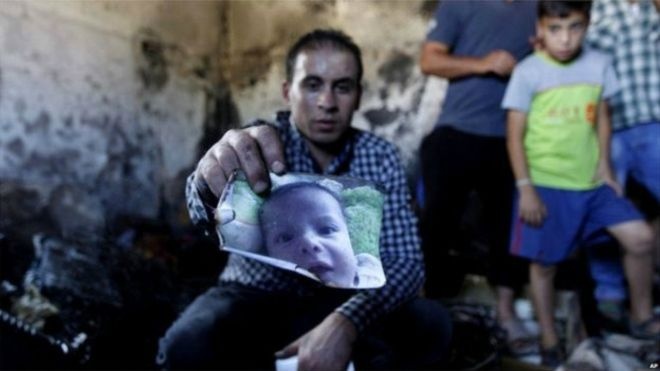 مقتل طفل فلسطيني حرقا في هجوم شنه مستوطنون اسرائيليون