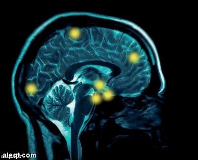 إصابة طفل أمريكي ببكتريا نادرة تأكل خلايا المخ