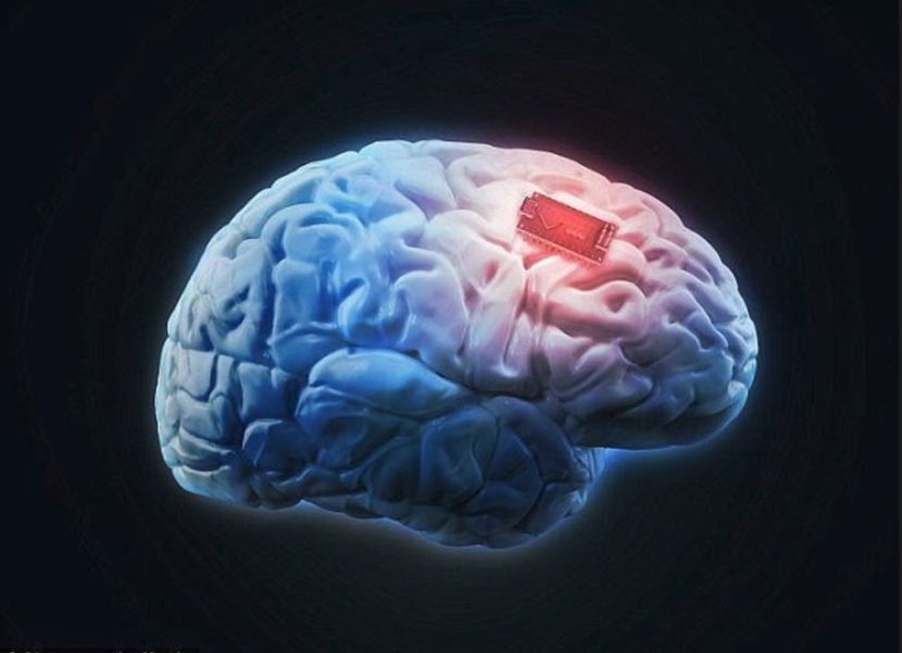جهاز إلكتروني جديد يزرع في المخ من أجل تنشيط الذاكرة