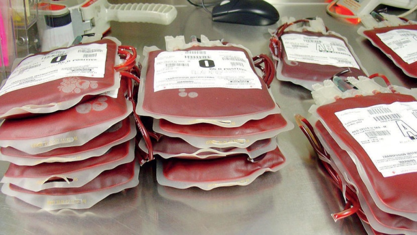 «بنوك الدم في المستشفيات الخاصة».. اشتراطات واجبة قبل الإنشاء