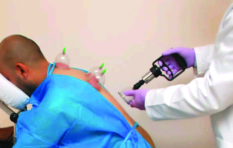 منح 45 عيادة تراخيص للحجامة.. و"الطب البديل" يحذر من المدعين