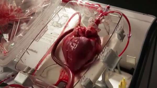 إبقاء قلب بصورة حية خارج الجسم 24 ساعة..تكنولوجيا قد تصبح متاحة للإنسان خلال سنة