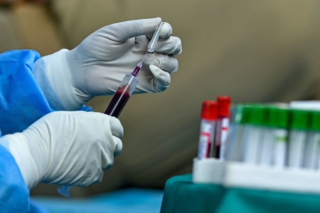 فاوتشي : لقاح كورونا قد يكون فعالا بشكل جزئي