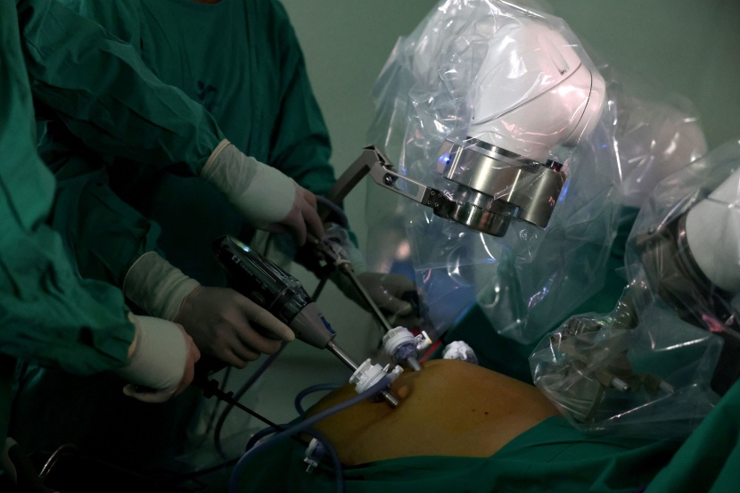 روبوت طبي يجري أولى عملياته الجراحية في مستشفى بتشيلي
