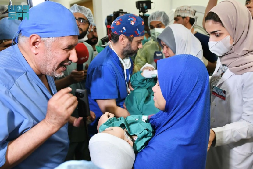 نجاح فصل التوأم السيامي الفلبيني "أكيزا وعائشة" بعد عملية استغرقت 5 ساعات
