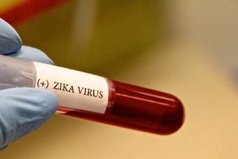 «زيكا» .. فيروس قاتل يصبح علاجا لسرطان الأطفال